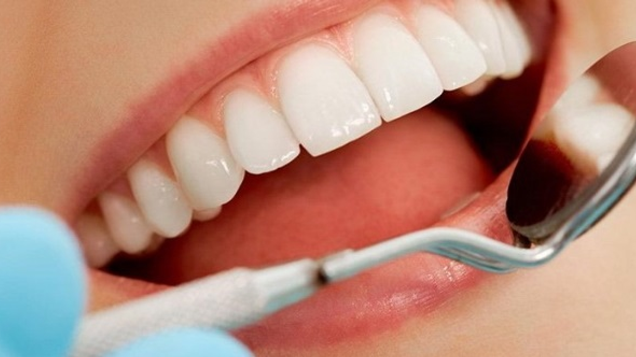 Ortodonti Tedavisi Nedir?