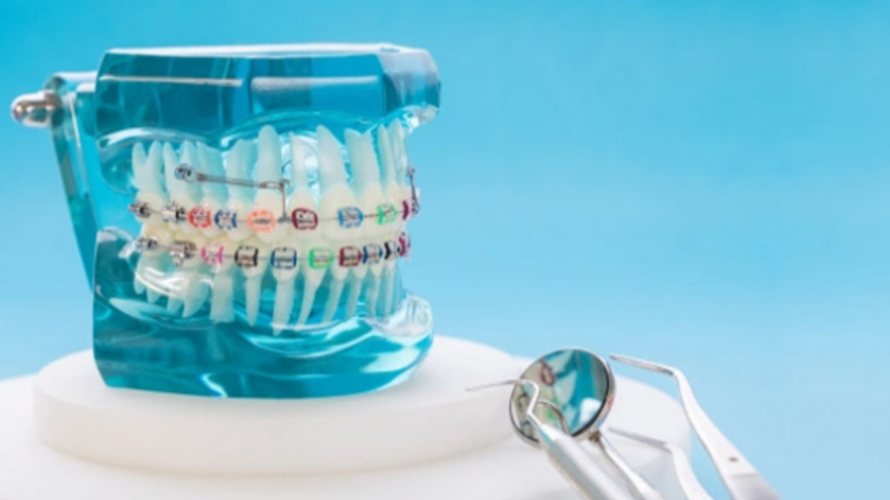 Ortodonti Nedir? İzmir ortodonti doktorları ve hastaneleri