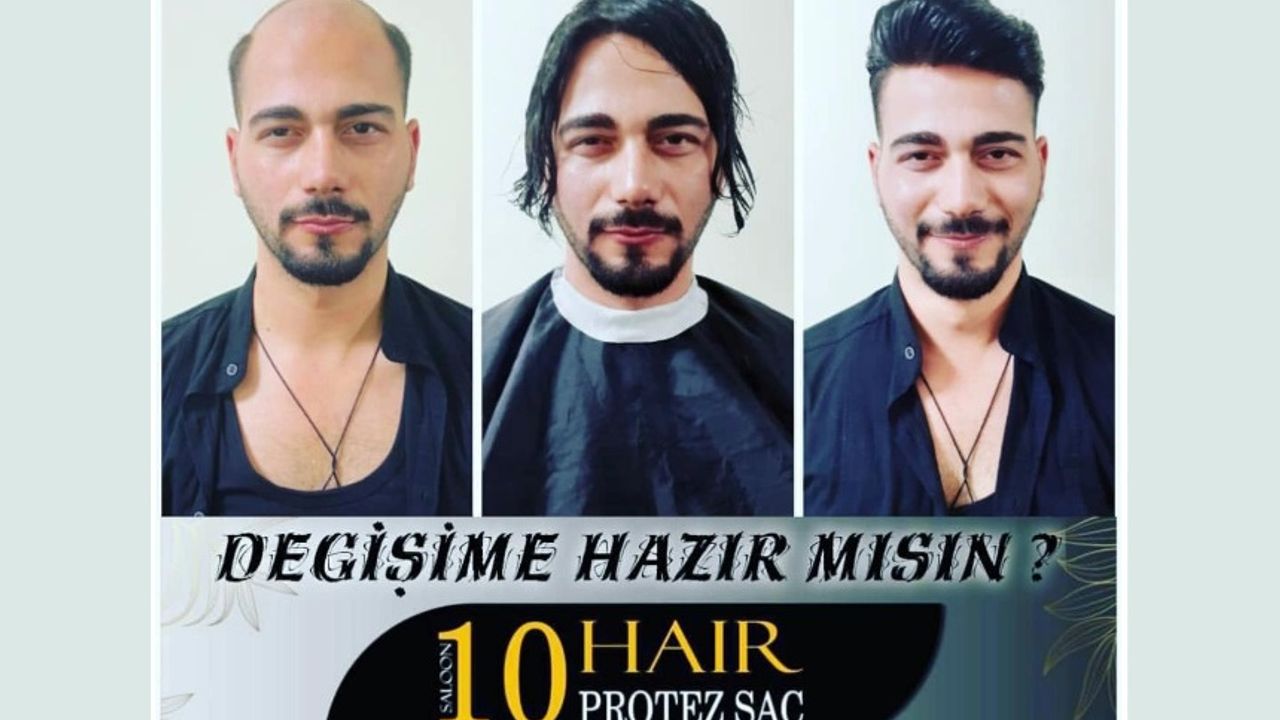 İzmir protez saç merkezi: Saloon 10 Hair