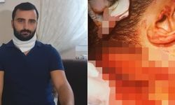 İzmir’de jiletle boğazı kesilen Doktor Kadir Songür dehşeti anlattı