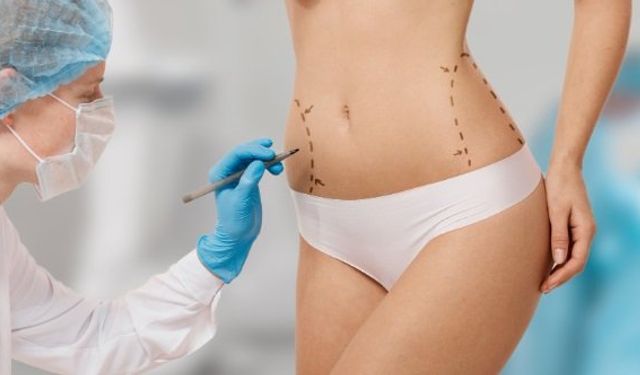 Liposuction Estetik Yöntemleri Nelerdir? – Dr. Ekrem Keskin