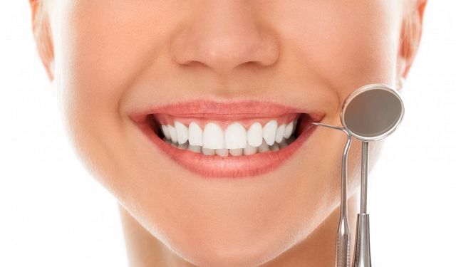 Diş Beyazlatma Tedavi Sonrası Dikkat Edilmesi Gerekenler Nelerdir?